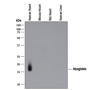 Western blot shows lysates of human heart tissue, mouse heart tissue (negative control), rat heart tissue (negative control), and human liver tissue (negative control). PVDF membrane was probed with 0.05 µg/mL of Mouse Anti-Human Myoglobin Monoclonal Antibody (Catalog # MAB97202) followed by HRP-conjugated Anti-Mouse IgG Secondary Antibody (Catalog # HAF018). A specific band was detected for Myoglobin at approximately 18 kDa (as indicated). This experiment was conducted under reducing conditions and using Immunoblot Buffer Group 1.