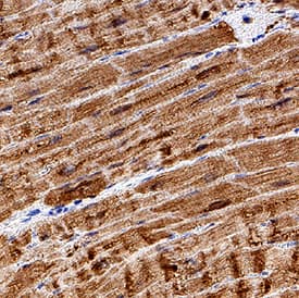 Immunohistochemistry Myoglobin Antibody (2269B) [Unconjugated]
