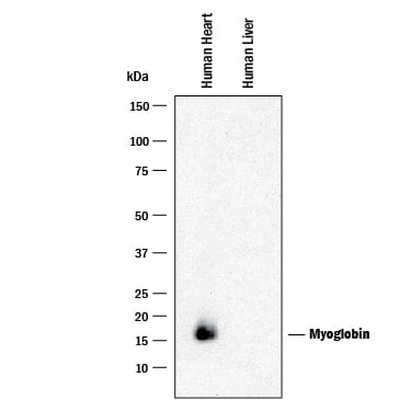 Western blot shows lysates of human heart tissue and human liver tissue (negative control). PVDF membrane was probed with 0.05 µg/mL of Rabbit Anti-Human Myoglobin Monoclonal Antibody (Catalog # MAB97204) followed by HRP-conjugated Anti-Rabbit IgG Secondary Antibody (Catalog # HAF008). A specific band was detected for Myoglobin at approximately 16 kDa (as indicated). This experiment was conducted under reducing conditions and using Immunoblot Buffer Group 1.