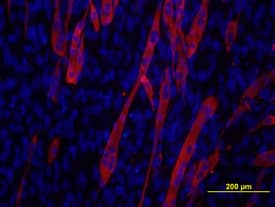 Myosin Heavy Chain was detected in immersion fixed C2C12 mouse myoblast cell line using Mouse Anti-Human Myosin Heavy Chain Monoclonal Antibody (Catalog # MAB4470) at 10 µg/mL for 3 hours at room temperature. Cells were stained using the NorthernLights™ 557-conjugated Anti-Mouse IgG Secondary Antibody (red; Catalog # NL007) and counter-stained with DAPI (blue). View our protocol for Fluorescent ICC Staining of Cells on Coverslips.