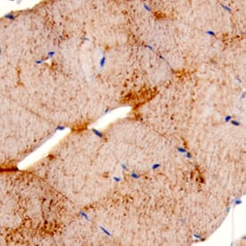 Myosin Heavy Chain was detected in perfusion fixed frozen sections of mouse skeletal muscle using Mouse Anti-Myosin Heavy Chain Monoclonal Antibody (Catalog # MAB4470) at 5 µg/mL for 1 hour at room temperature followed by incubation with the Anti-Mouse IgG VisUCyte™ HRP Polymer Antibody (Catalog # VC001). Before incubation with the primary antibody, tissue was subjected to heat-induced epitope retrieval using Antigen Retrieval Reagent-Basic (Catalog # CTS013). Tissue was stained using DAB (brown) and counterstained with hematoxylin (blue). Specific staining was localized to sarcoplasm. View our protocol for IHC Staining with VisUCyte HRP Polymer Detection Reagents.