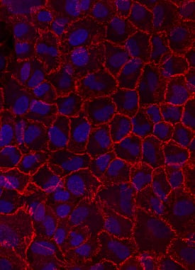 Immunocytochemistry N-Cadherin Antibody [Unconjugated]