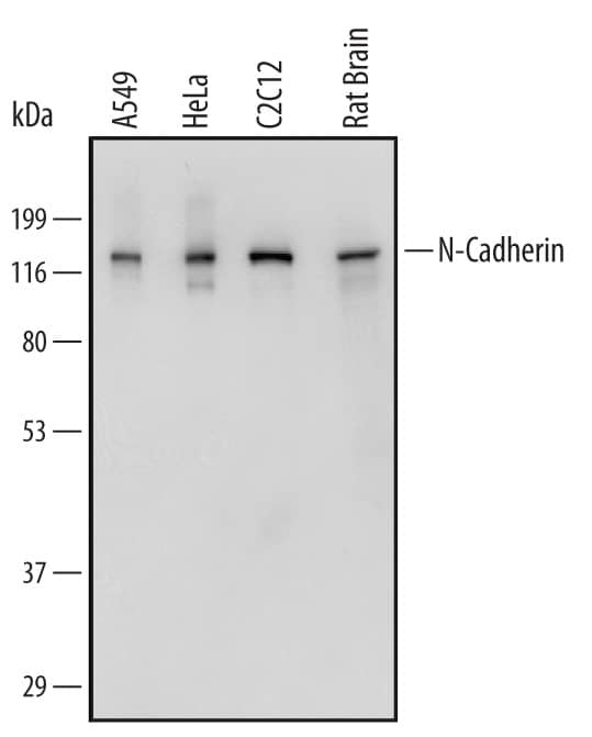 Western Blot N-Cadherin Antibody [Unconjugated]