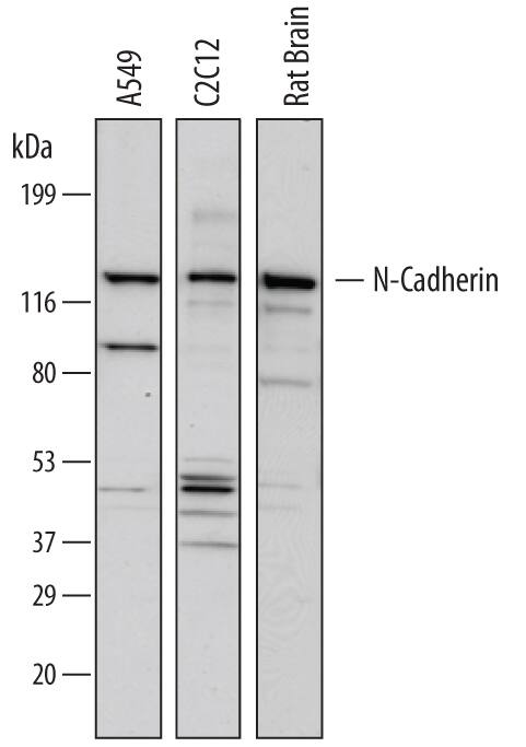 Western blot shows lysates of A549 human lung carcinoma cell line, C2C12 mouse myoblast cell line, and rat brain tissue. PVDF membrane was probed with 1 µg/mL of Mouse Anti-Human N-Cadherin Monoclonal Antibody (Catalog # MAB13881) followed by HRP-conjugated Anti-Mouse IgG Secondary Antibody (Catalog # HAF007). A specific band was detected for N-Cadherin at approximately 130 kDa (as indicated). This experiment was conducted under reducing conditions and using Immunoblot Buffer Group 1.