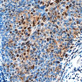Immunohistochemistry NAC1 Antibody [Unconjugated]