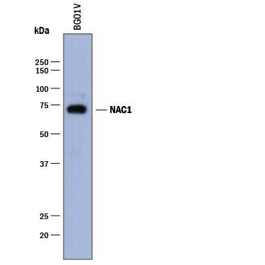 Western Blot NAC1 Antibody [Unconjugated]