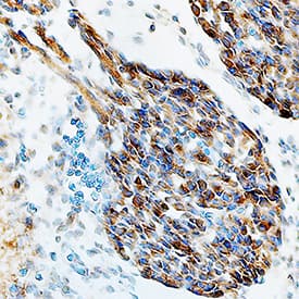 Immunohistochemistry NAC1 Antibody (1243A) [Unconjugated]