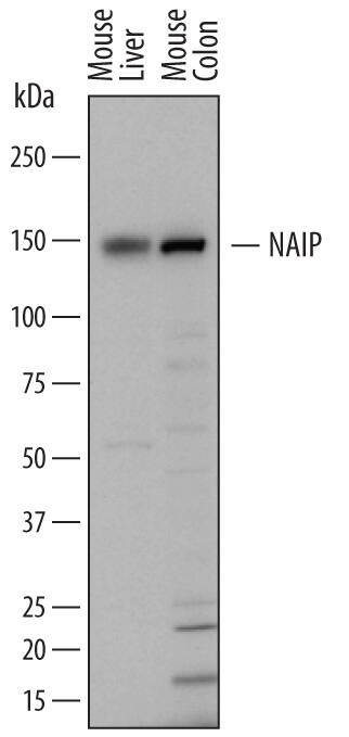 Western blot shows lysates of mouse liver tissue and mouse colon tissue. PVDF membrane was probed with 1 µg/mL of Sheep Anti-Mouse NAIP Antigen Affinity-purified Polyclonal Antibody (Catalog # AF7608) followed by HRP-conjugated Anti-Sheep IgG Secondary Antibody (Catalog # HAF016). A specific band was detected for NAIP at approximately 150 kDa (as indicated). This experiment was conducted under reducing conditions and using Immunoblot Buffer Group 1.