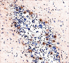 Immunohistochemistry NAIP Antibody (541609) [Unconjugated]