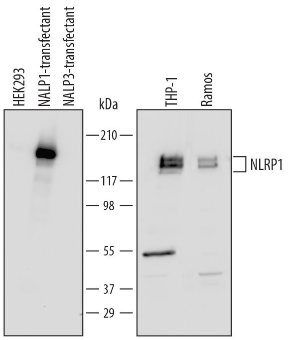 Western blot shows lysates of HEK293 human embryonic kidney cell line either mock transfected, transfected with human NLRP1/NALP1 or transfected with NALP3, THP-1 human acute monocytic leukemia cell line, and Ramos human Burkitt's lymphoma cell line. PVDF Membrane was probed with 0.5 µg/mL of Sheep Anti-Human NLRP1/NALP1 Antigen Affinity-purified Polyclonal Antibody (Catalog # AF6788) followed by HRP-conjugated Anti-Sheep IgG Secondary Antibody (Catalog # HAF016). Specific bands were detected for NLRP1/NALP1 at approximately 160 kDa (as indicated). This experiment was conducted under reducing conditions and using Immunoblot Buffer Group 2.