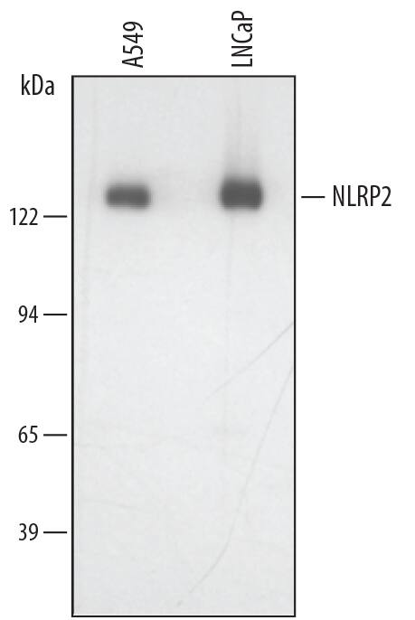 Western blot shows lysates of A549 human lung carcinoma cell line and LNCaP human prostate cancer cell line. PVDF membrane was probed with 1 µg/mL of Mouse Anti-Human NLRP2/NALP2 Monoclonal Antibody (Catalog # MAB4684) followed by HRP-conjugated Anti-Mouse IgG Secondary Antibody (Catalog # HAF007). A specific band was detected for NLRP2/NALP2 at approximately 130 kDa (as indicated). This experiment was conducted under reducing conditions and using Immunoblot Buffer Group 2.
