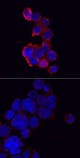 NLRP3/NALP3 was detected in immersion fixed THP-1 human acute monocytic leukemia cells, unstimulated (lower panel) and stimulated (upper panel) with PMA and LPS, using Sheep Anti-Human NLRP3/NALP3 Antigen Affinity-purified Polyclonal Antibody (Catalog # AF6789) at 10 µg/mL for 3 hours at room temperature. Cells were stained using the NorthernLights™ 557-conjugated Anti-Sheep IgG Secondary Antibody (red; Catalog # NL010) and counterstained with DAPI (blue). Specific staining was localized to cytoplasm. View our protocol for Fluorescent ICC Staining of Non-adherent Cells.
