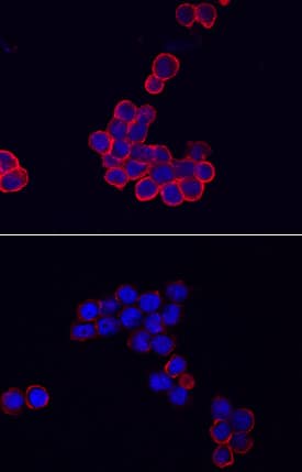NLRP3/NALP3 was detected in immersion fixed THP-1 human acute monocytic leukemia cell line, unstimulated (lower panel) or stimulated (upper panel) with 50 ng/mL PMA and 200 ng/mL LPS, using Goat Anti-Human NLRP3/NALP3 Antigen Affinity-purified Polyclonal Antibody (Catalog # AF7010) at 10 µg/mL for 3 hours at room temperature. Cells were stained using the NorthernLights™ 557-conjugated Anti-Goat IgG Secondary Antibody (red; Catalog # NL001) and counterstained with DAPI (blue). Specific staining was localized to cell surfaces and cytoplasm. View our protocol for Fluorescent ICC Staining of Non-adherent Cells.