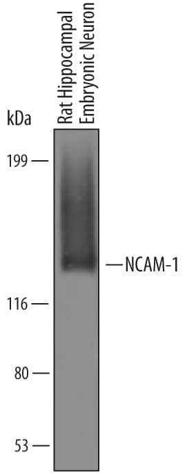 Western blot shows lysates of rat hippocampal embryonic neurons. PVDF Membrane was probed with 1 µg/mL of Mouse NCAM-1/CD56 Antigen Affinity-purified Polyclonal Antibody (Catalog # AF6070) followed by HRP-conjugated Anti-Sheep IgG Secondary Antibody (Catalog # HAF016). A specific band was detected for NCAM-1/CD56 at approximately 140 kDa (as indicated). This experiment was conducted under reducing conditions and using Immunoblot Buffer Group 8.