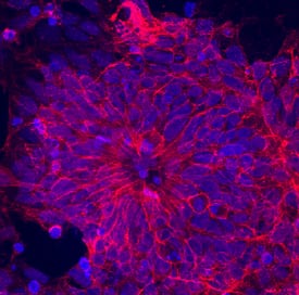 Immunocytochemistry NCAM-1/CD56 Antibody [Unconjugated]
