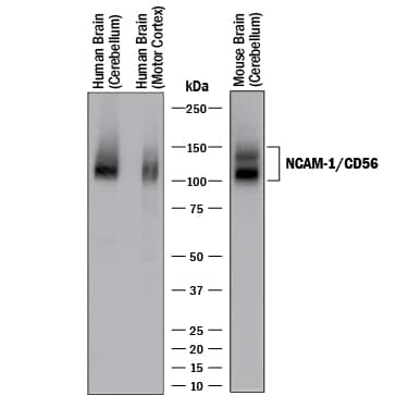 Western Blot NCAM-1/CD56 Antibody [Unconjugated]