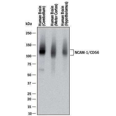 Western blot shows lysates of human brain (cerebellum) tissue, human brain (motor cortex) tissue, and human brain (hypothalamus) tissue. PVDF membrane was probed with 0.5 µg/mL of Mouse Anti-Human NCAM-1/CD56 Monoclonal Antibody (Catalog # MAB24084) followed by HRP-conjugated Anti-Mouse IgG Secondary Antibody (Catalog # HAF018). A specific band was detected for NCAM-1/CD56 at approximately 120 kDa (as indicated). This experiment was conducted under reducing conditions and using Immunoblot Buffer Group 1.