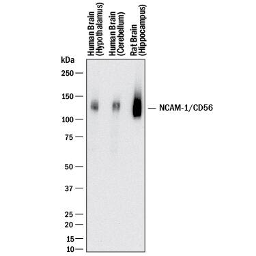 Western blot shows lysates of human brain (hypothalamus) tissue, human brain (cerebellum) tissue, and rat brain (hippocampus) tissue. PVDF membrane was probed with 1 µg/mL of Rabbit Anti-Human/Rat NCAM-1/CD56 Monoclonal Antibody (Catalog # MAB24085) followed by HRP-conjugated Anti-Rabbit IgG Secondary Antibody (Catalog # HAF008). A specific band was detected for NCAM-1/CD56 at approximately 140 kDa (as indicated). This experiment was conducted under reducing conditions and using Immunoblot Buffer Group 1.