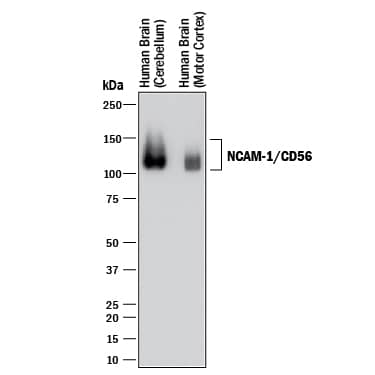 Western blot shows lysates of human brain (cerebellum) tissue and human brain (motor cortex) tissue. PVDF membrane was probed with 1 µg/mL of Mouse Anti-Human/Primate NCAM-1/CD56 Monoclonal Antibody (Catalog # MAB2408) followed by HRP-conjugated Anti-Mouse IgG Secondary Antibody (Catalog # HAF018). A specific band was detected for NCAM-1/CD56 at approximately 100-150 kDa (as indicated). This experiment was conducted under reducing conditions and using Immunoblot Buffer Group 1.