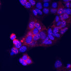 Immunocytochemistry NCK1 Antibody (714506)