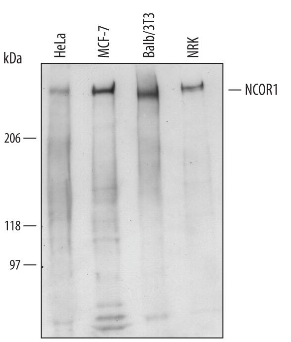 Western Blot NCOR1 Antibody [Unconjugated]