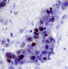 Immunohistochemistry NCOR2 Antibody