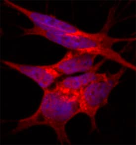 Immunocytochemistry NDFIP1 Antibody