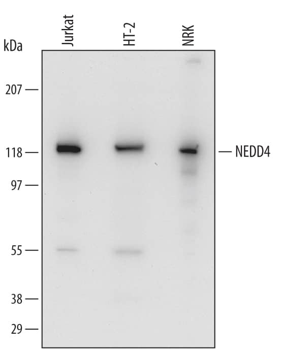 Western blot shows lysates of Jurkat human acute T cell leukemia cell line, HT-2 mouse T cell line, and NRK rat normal kidney cell line. PVDF Membrane was probed with 1 µg/mL of Sheep Anti-Human/Mouse/Rat NEDD4 Antigen Affinity-purified Polyclonal Antibody (Catalog # AF6218) followed by HRP-conjugated Anti-Sheep IgG Secondary Antibody (Catalog # HAF016). A specific band was detected for NEDD4 at approximately 118 kDa (as indicated). This experiment was conducted under reducing conditions and using Immunoblot Buffer Group 2.