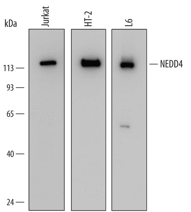 Western blot shows lysates of Jurkat human acute T cell leukemia cell line, HT-2 mouse T cell line, and L6 rat myoblast cell line. PVDF Membrane was probed with 0.5 µg/mL of Mouse Anti-Human NEDD4 Monoclonal Antibody (Catalog # MAB6218) followed by HRP-conjugated Anti-Mouse IgG Secondary Antibody (Catalog # HAF007). A specific band was detected for NEDD4 at approximately 118 kDa (as indicated). This experiment was conducted under reducing conditions and using Immunoblot Buffer Group 2.