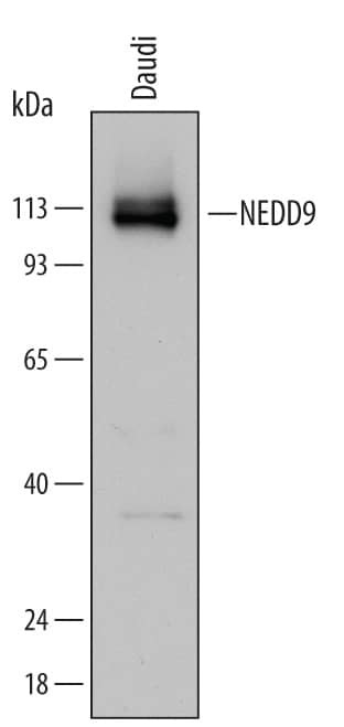 Western Blot NEDD9/CASL/HEF1 Antibody (584825)