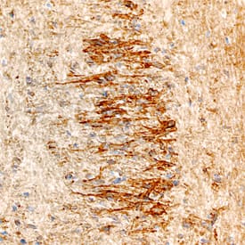 Immunohistochemistry NELL1 Antibody