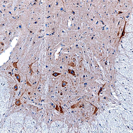 NELL2 was detected in perfusion fixed frozen sections of mouse spinal cord using Sheep Anti-Mouse NELL2 Antigen Affinity-purified Polyclonal Antibody (Catalog # AF6736) at 15 µg/mL overnight at 4 °C. Tissue was stained using the Anti-Sheep HRP-DAB Cell & Tissue Staining Kit (brown; Catalog # CTS019) and counterstained with hematoxylin (blue). Specific staining was localized to motoneurons. View our protocol for Chromogenic IHC Staining of Frozen Tissue Sections.
