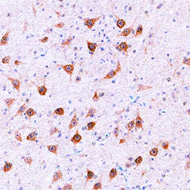 Immunohistochemistry NETO1 Antibody [Unconjugated]