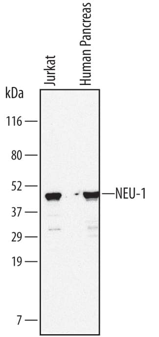 Western Blot NEU-1/Sialidase-1 Antibody (688215)