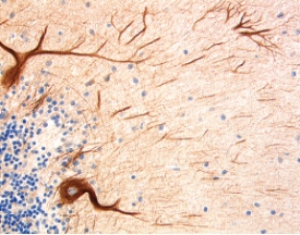 NF-H was detected in immersion fixed paraffin-embedded sections of human brain (cerebellum) using 15 µg/mL Goat Anti-Human NF-H Antigen Affinity-purified Polyclonal Antibody (Catalog # AF3108) overnight at 4 °C. Tissue was stained with the Anti-Goat HRP-DAB Cell & Tissue Staining Kit (brown; Catalog # CTS008) and counterstained with hematoxylin (blue). View our protocol for Chromogenic IHC Staining of Paraffin-embedded Tissue Sections.