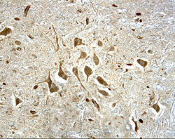 NF-L was detected in immersion fixed paraffin-embedded sections of human spinal cord using 25 µg/mL Mouse Anti-Human NF-L Monoclonal Antibody (Catalog # MAB2216) overnight at 4 °C. Tissue was stained with the Anti-Mouse HRP-DAB Cell & Tissue Staining Kit (brown; CTS002) and counter-stained with hematoxylin (blue). Specific labeling was localized to the cytoplasm in motor neurons. View our protocol for Chromogenic IHC Staining of Paraffin-embedded Tissue Sections.