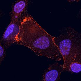 Immunocytochemistry NF2/Merlin Antibody [Unconjugated]
