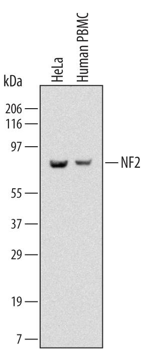 Western blot shows lysates of HeLa human cervical epithelial carcinoma cell line and human peripheral blood mononuclear cells (PBMC). PVDF Membrane was probed with 2 µg/mL of Mouse Anti-Human NF2/Merlin Monoclonal Antibody (Catalog # MAB5616) followed by HRP-conjugated Anti-Mouse IgG Secondary Antibody (Catalog # HAF007). A specific band was detected for NF2/Merlin at approximately 70 kDa (as indicated). This experiment was conducted under reducing conditions and using Immunoblot Buffer Group 1.