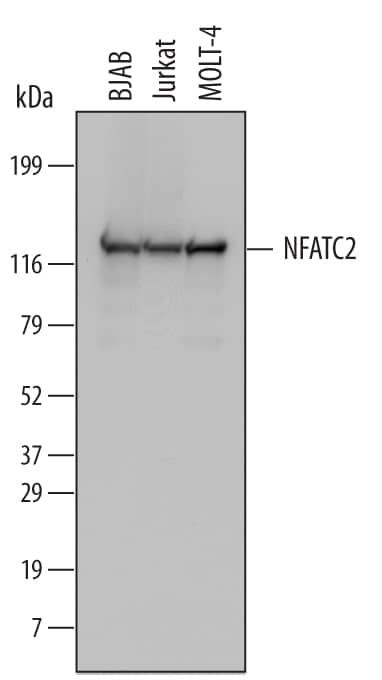 Western blot shows lysates of BJAB human Burkitt's lymphoma cell line, Jurkat human acute T cell leukemia cell line, and MOLT-4 human acute lymphoblastic leukemia cell line. PVDF Membrane was probed with 0.5 µg/mL of Human NFATC2 Monoclonal Antibody (Catalog # MAB6499) followed by HRP-conjugated Anti-Mouse IgG Secondary Antibody (Catalog # HAF007). A specific band was detected for NFATC2 at approximately 130 kDa (as indicated). This experiment was conducted under reducing conditions and using Immunoblot Buffer Group 1.