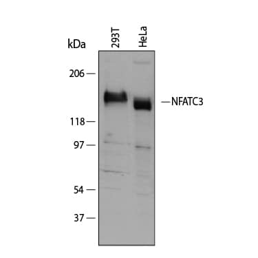 Western Blot NFATC3/NFAT4 Antibody [Unconjugated]