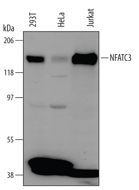 Western Blot NFATC3/NFAT4 Antibody (646115)
