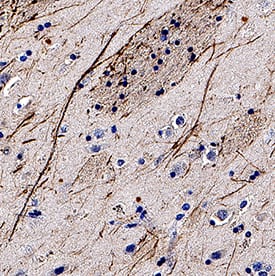 NF-H was detected in immersion fixed paraffin-embedded sections of human brain (caudate nucleus) using Mouse Anti-Human NF-H Monoclonal Antibody (Catalog # MAB31081) at 5 µg/mL for 1 hour at room temperature followed by incubation with the Anti-Mouse IgG VisUCyte™ HRP Polymer Antibody (Catalog # VC001). Before incubation with the primary antibody, tissue was subjected to heat-induced epitope retrieval using Antigen Retrieval Reagent-Basic (Catalog # CTS013). Tissue was stained using DAB (brown) and counterstained with hematoxylin (blue). Specific staining was localized to neurofilaments. View our protocol for IHC Staining with VisUCyte HRP Polymer Detection Reagents.