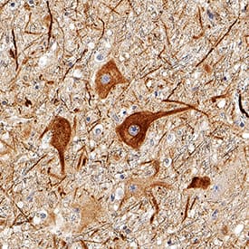 NF-L was detected in immersion fixed paraffin-embedded sections of human brain (substantia nigra) using Mouse Anti-Human NF-L Monoclonal Antibody (Catalog # MAB2216) at 3 µg/mL for 1 hour at room temperature followed by incubation with the Anti-Mouse IgG VisUCyte™ HRP Polymer Antibody (VC001). Tissue was stained using DAB (brown) and counterstained with hematoxylin (blue). Specific staining was localized to cytoplasm in neurons. View our protocol for IHC Staining with VisUCyte HRP Polymer Detection Reagents.