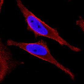 Immunocytochemistry NFkB2/NFkB p100 Antibody (291319) [Unconjugated]