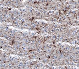 Immunohistochemistry NG2/MCSP Antibody (546930)