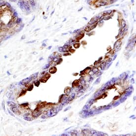NGFRAP1/BEX3 was detected in immersion fixed paraffin-embedded sections of human prostate using Mouse Anti-Human NGFRAP1/BEX3 Monoclonal Antibody (Catalog # MAB6858) at 15 µg/mL overnight at 4 °C. Before incubation with the primary antibody, tissue was subjected to heat-induced epitope retrieval using Antigen Retrieval Reagent-Basic (Catalog # CTS013). Tissue was stained using the Anti-Mouse HRP-DAB Cell & Tissue Staining Kit (brown; Catalog # CTS002) and counterstained with hematoxylin (blue). Specific staining was localized to epithelial cells. View our protocol for Chromogenic IHC Staining of Paraffin-embedded Tissue Sections.