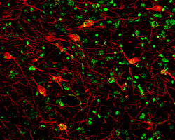 Immunohistochemistry NGFR/TNFRSF16/p75NTR Antibody [Unconjugated]