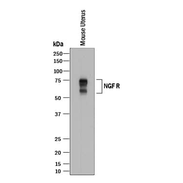 Western Blot NGFR/TNFRSF16/p75NTR Antibody [Unconjugated]