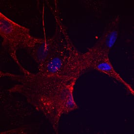 Immunocytochemistry NGFR/TNFRSF16/p75NTR Antibody (74902) [Unconjugated]