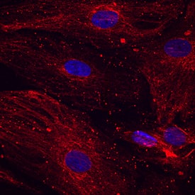 Immunocytochemistry NGFR/TNFRSF16/p75NTR Antibody (74902) [Unconjugated]
